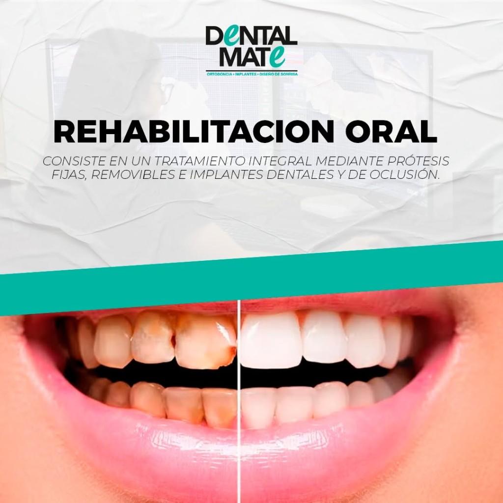 Rehabilitación oral