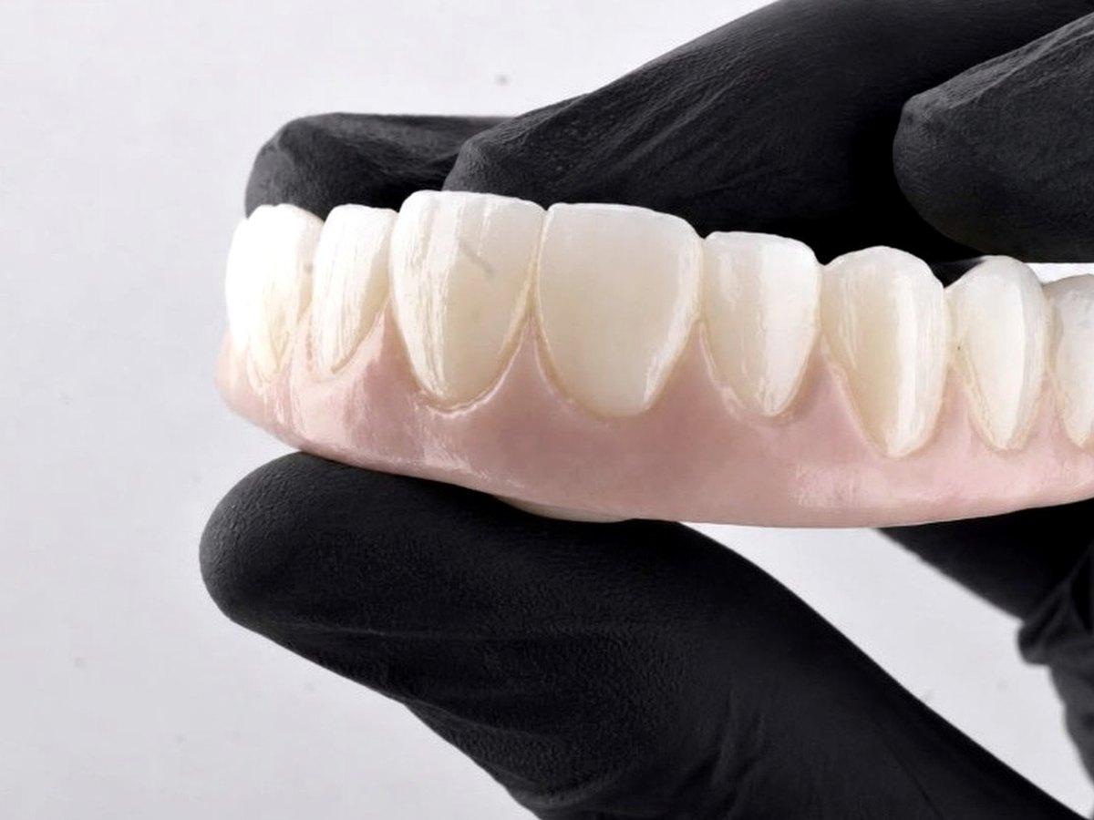 Puentes dentales