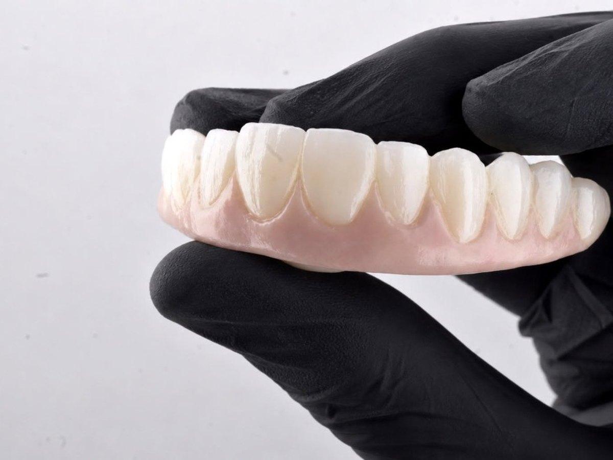 Puentes dentales