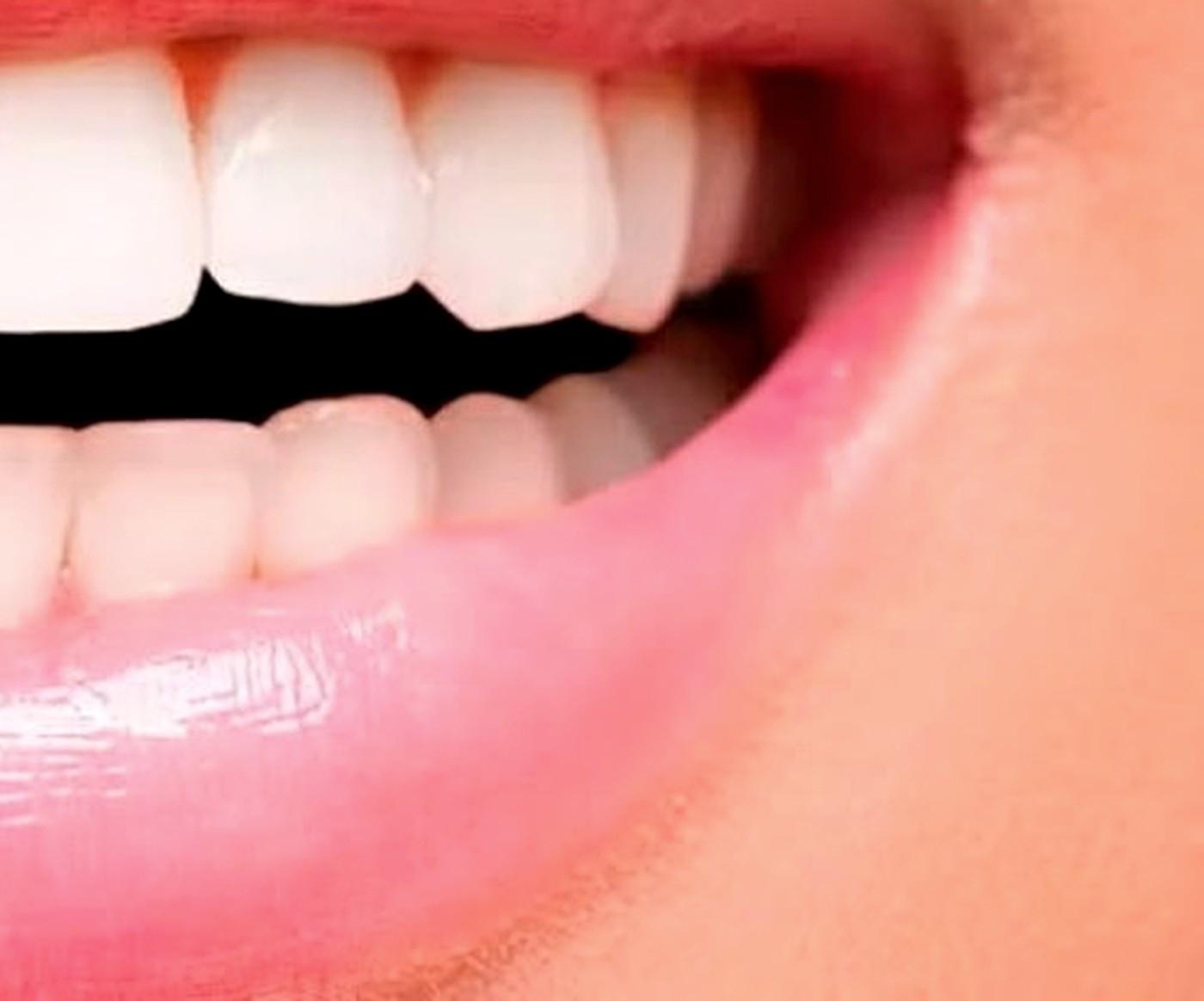 Rehabilitación oral