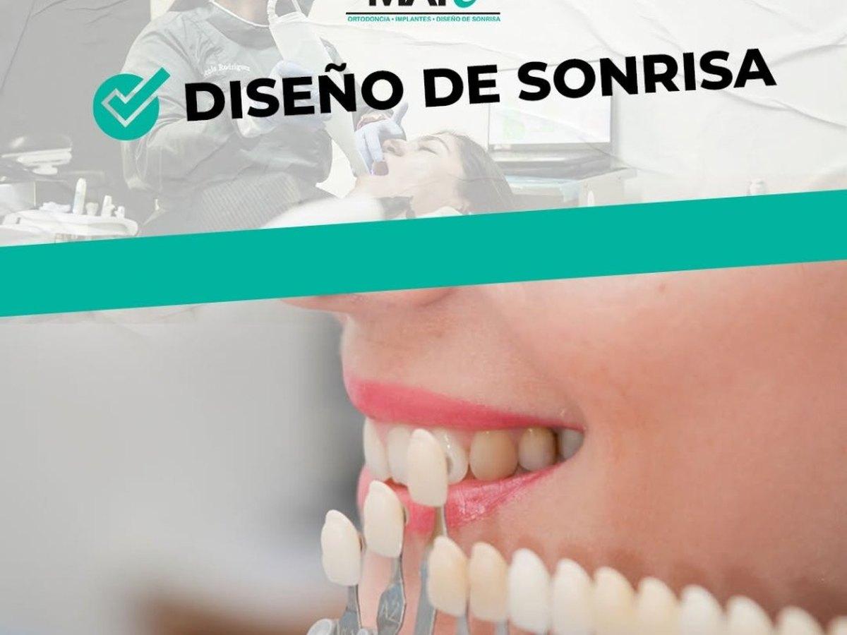 Tratamiento periodontal